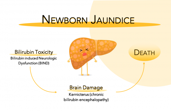 When Your Baby Turns Yellow - The Real Factors Behind Jaundice